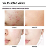 Photon Specific Skincare Introduction Device Massage